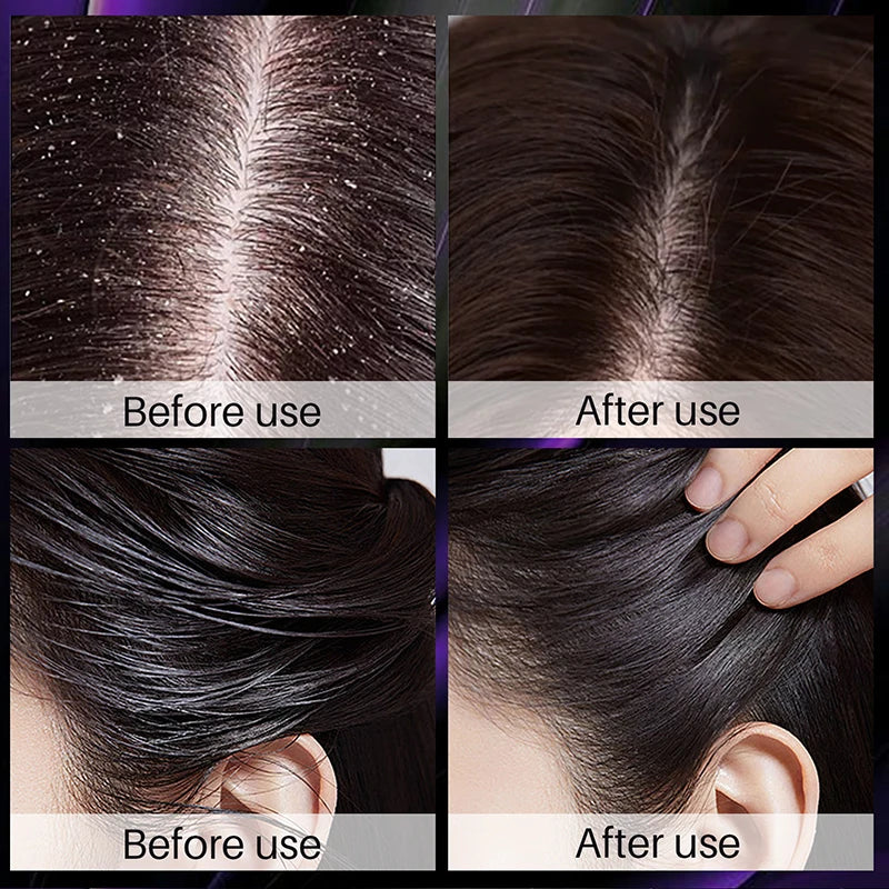 Hair Growth Cleansing Shampoo