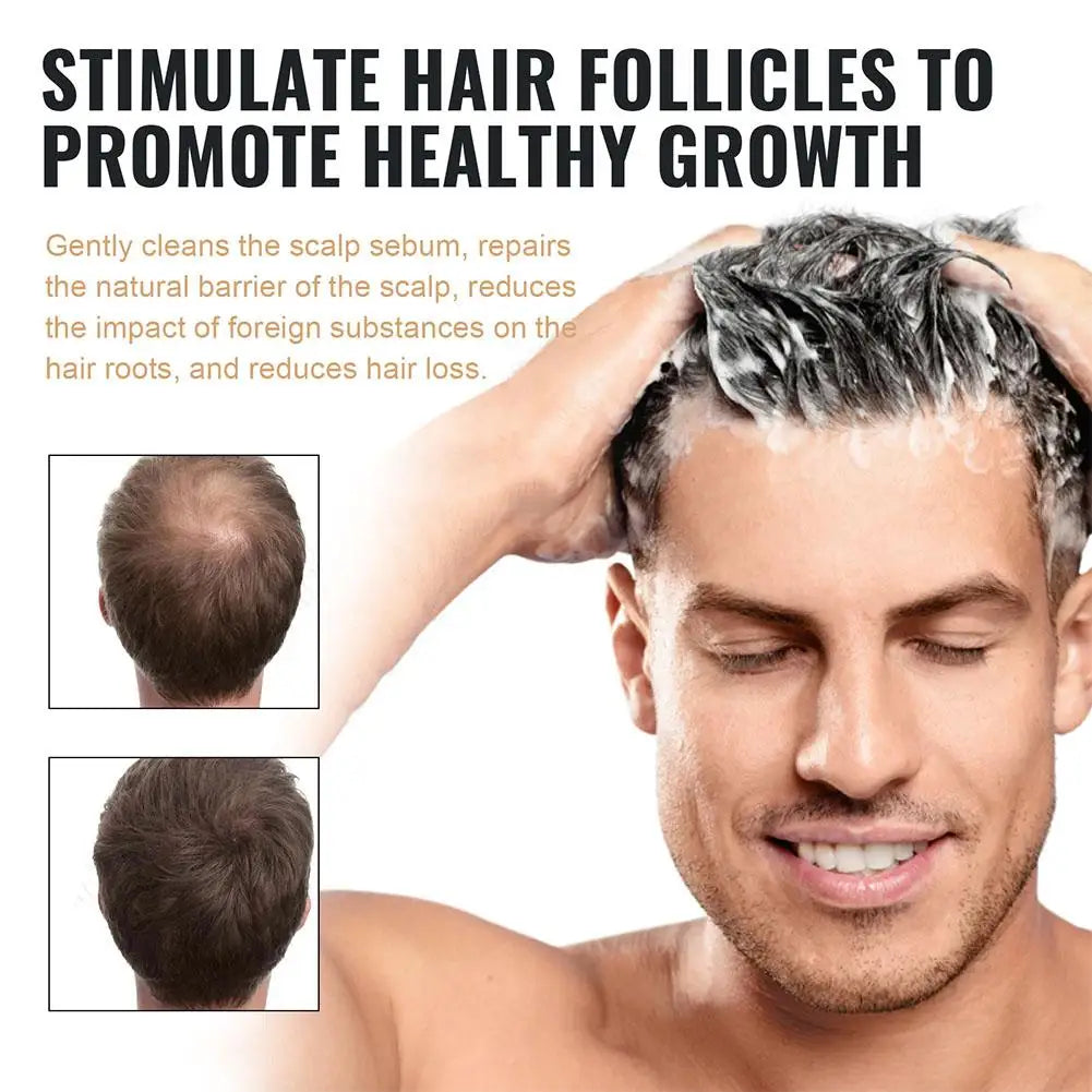 Hair Loss Treatment Shampoo Promotes Growth