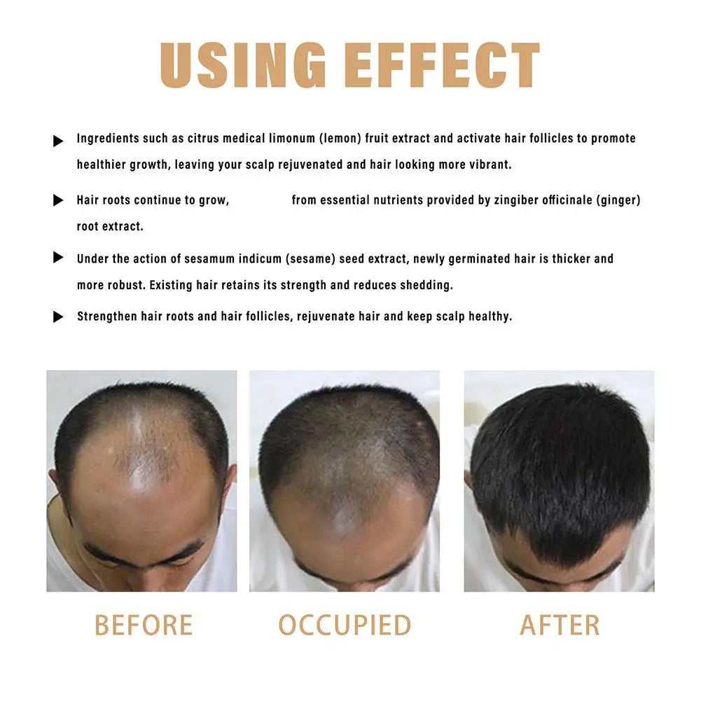 Hair Loss Treatment Shampoo Promotes Growth